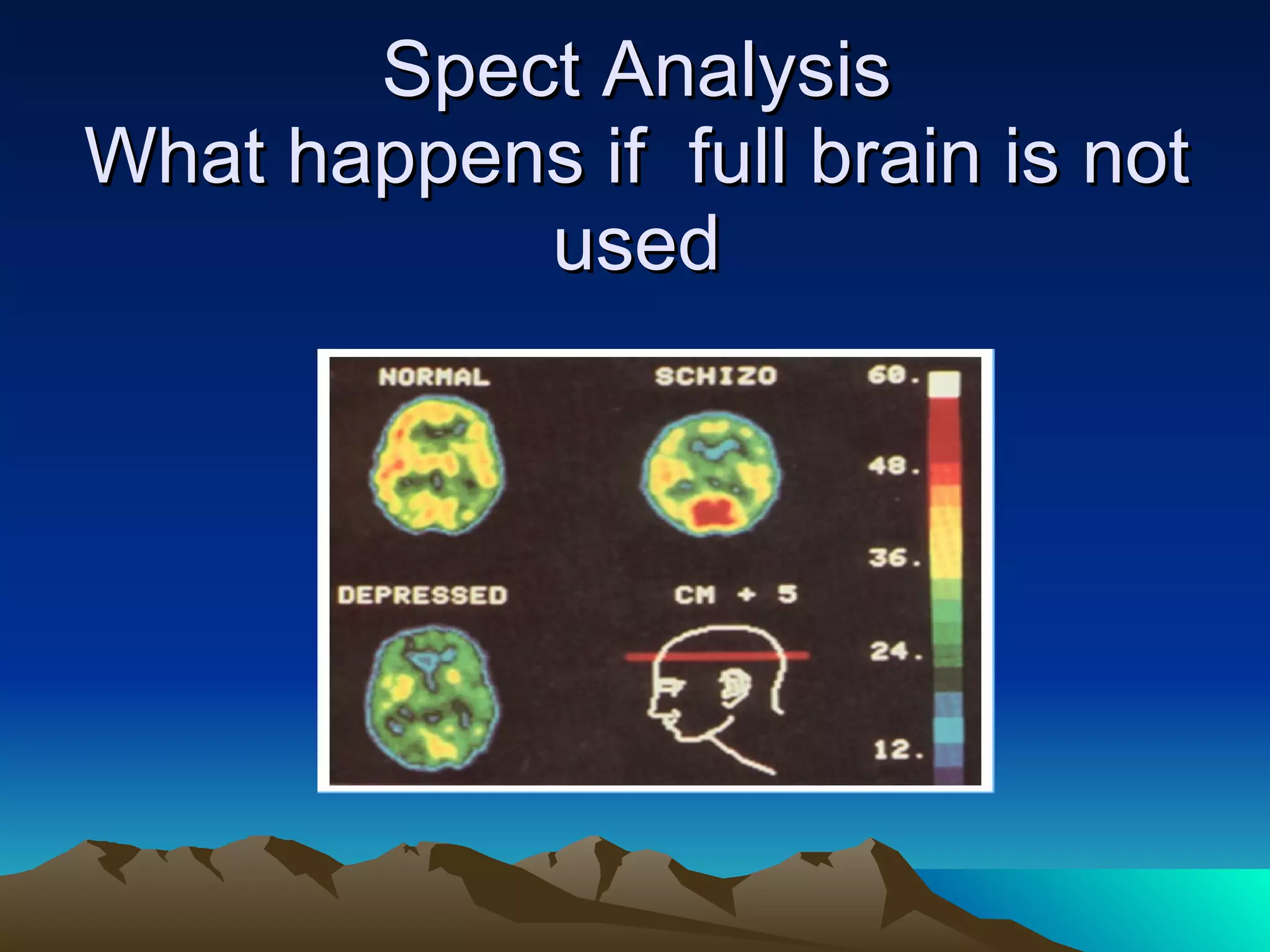 Spect Analysis What happens if  full brain is not used 