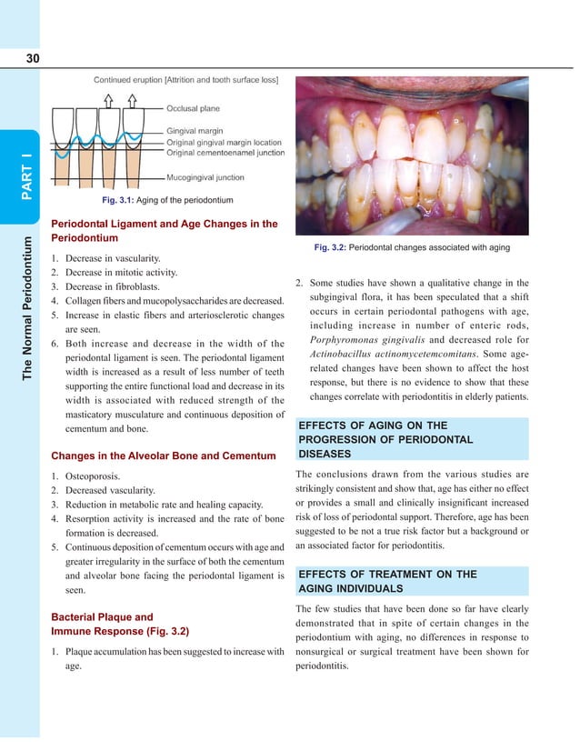 Essentials of clinical periodontology and periodontics