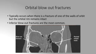 Orbital blow out fractures
• Typically occurs when there is a fracture of one of the walls of orbit
but the orbital rim remains intact
• Inferior blow-out fractures are the most common.
 