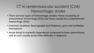 • There are two types of hemorrhagic strokes: those caused by an
intracerebral hemorrhage (ICH) and those caused by a subarachnoid
hemorrhage (SAH)
• Common locations: Basal ganglia and thalamus, pons and cerebellar
hemisphere
• Acute blood is markedly hyperdense compared to brain parenchyma,
and as such usually poses little difficulty in diagnosis.
CT in cerebrovascular accident (CVA)
Hemorrhagic stroke
 