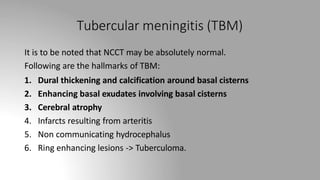 Tubercular meningitis (TBM)
It is to be noted that NCCT may be absolutely normal.
Following are the hallmarks of TBM:
1. Dural thickening and calcification around basal cisterns
2. Enhancing basal exudates involving basal cisterns
3. Cerebral atrophy
4. Infarcts resulting from arteritis
5. Non communicating hydrocephalus
6. Ring enhancing lesions -> Tuberculoma.
 