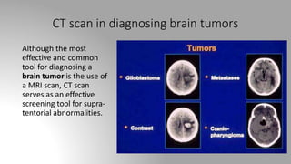 CT scan in diagnosing brain tumors
Although the most
effective and common
tool for diagnosing a
brain tumor is the use of
a MRI scan, CT scan
serves as an effective
screening tool for supra-
tentorial abnormalities.
 