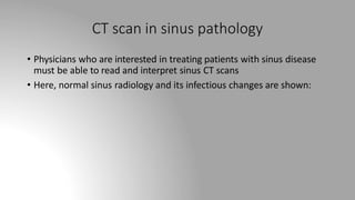 CT scan in sinus pathology
• Physicians who are interested in treating patients with sinus disease
must be able to read and interpret sinus CT scans
• Here, normal sinus radiology and its infectious changes are shown:
 