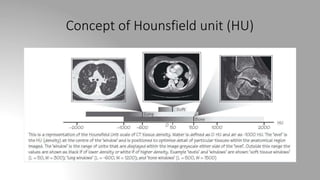 Concept of Hounsfield unit (HU)
 