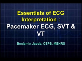Essentials of ECG
    Interpretation :
Pacemaker ECG, SVT &
        VT
 