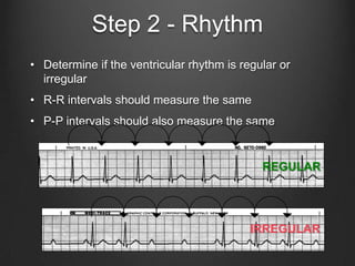 Essentials of ecg interpretation aphrs | PPTX