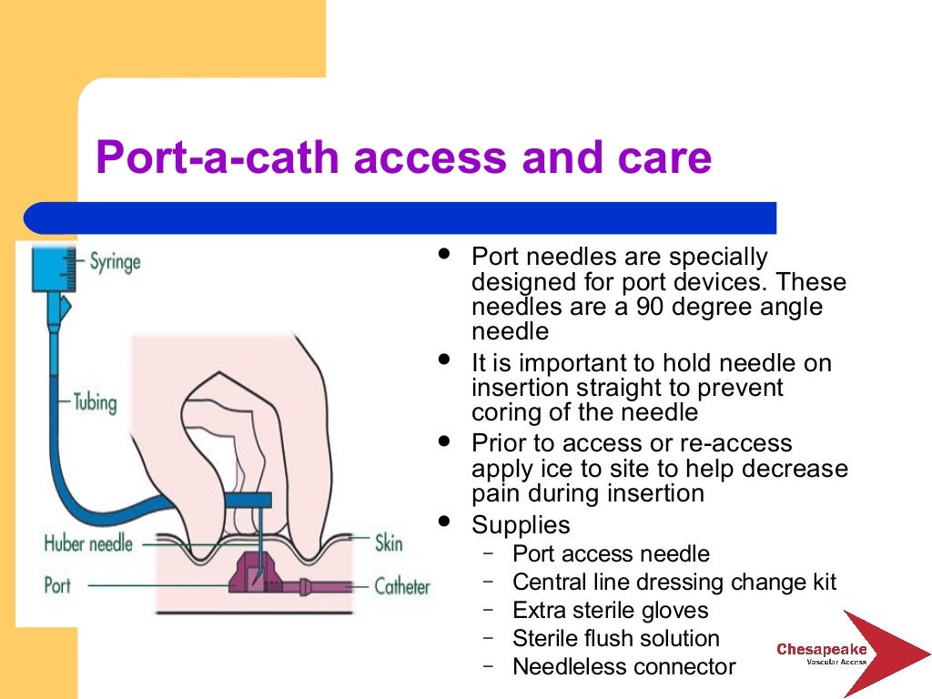 Essentials of vascular access