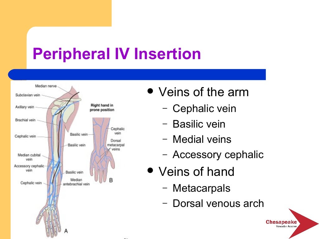 Essentials of vascular access