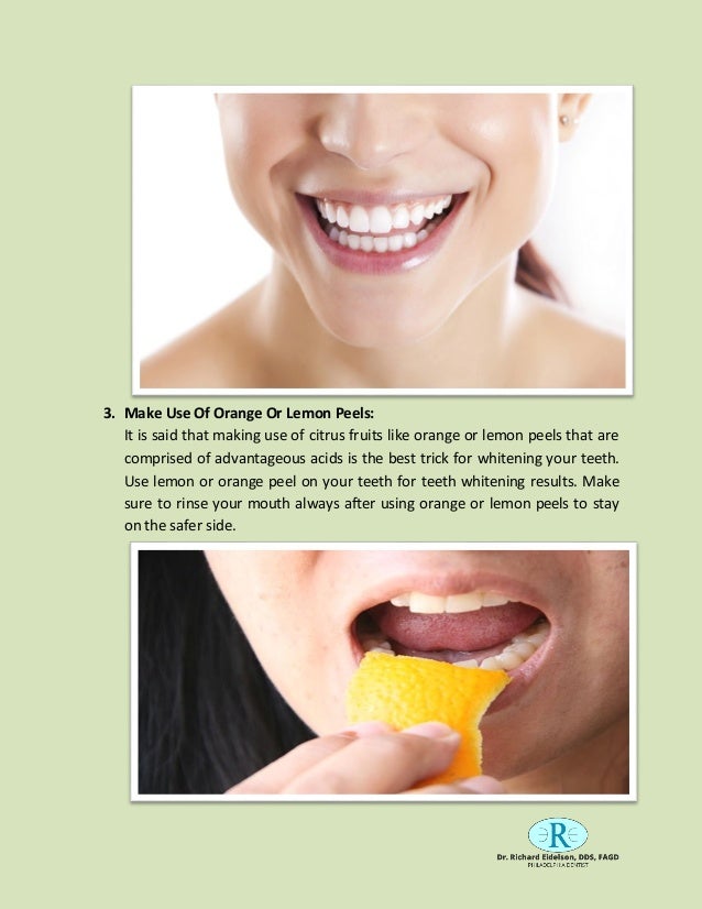 Essential tips for whiten your teeth - OpenYourMouth Essential tips for whiten your teeth - OpenYourMouth