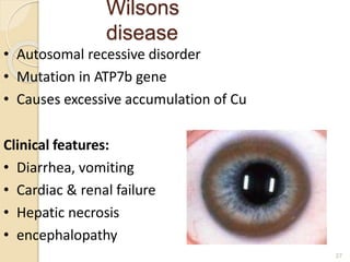 Wilsons
disease
27
• Autosomal recessive disorder
• Mutation in ATP7b gene
• Causes excessive accumulation of Cu
Clinical features:
• Diarrhea, vomiting
• Cardiac & renal failure
• Hepatic necrosis
• encephalopathy
 