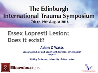 Essex Lopresti Lesion:
Does it exist?
Adam C Watts
Consultant Elbow and Upper Limb Surgeon, Wrightington
Hospital
Visiting Professor, University of Manchester
1
 