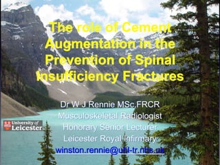 Dr W J Rennie MSc,FRCR
Musculoskeletal Radiologist
Honorary Senior Lecturer
Leicester Royal Infirmary
winston.rennie@uhl-tr.nhs.uk
The role of Cement
Augmentation in the
Prevention of Spinal
Insufficiency Fractures
 