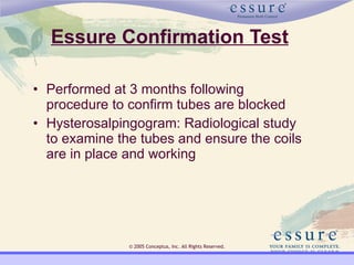 Essure | PPT