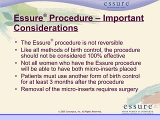 Essure | PPT