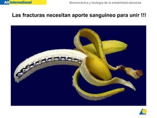 Biomecánica y biología de la estabilidad absoluta
Las fracturas necesitan aporte sanguíneo para unir !!!
 