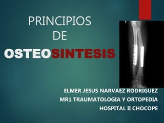 PRINCIPIOS
DE
OSTEOSINTESIS
ELMER JESUS NARVAEZ RODRIGUEZ
MR1 TRAUMATOLOGIA Y ORTOPEDIA
HOSPITAL II CHOCOPE
 