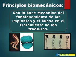 Principios biomecánicos:
 