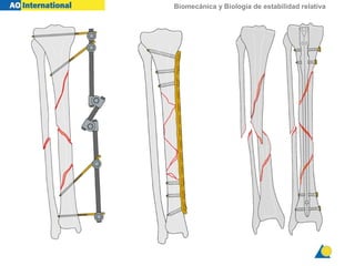 Biomecánica y Biología de estabilidad relativa
 