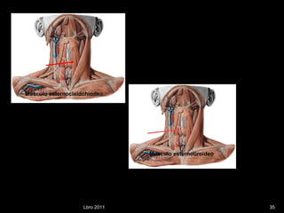 Lbro 2011 Músculo esternocleidohiodeo Músculo esternotiroideo 