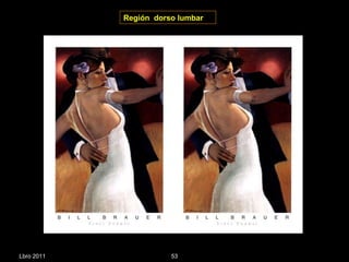 Región  dorso lumbar Lbro 2011 