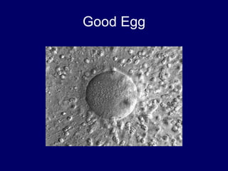 Good Egg
 