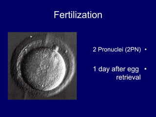 Fertilization
•2 Pronuclei (2PN)
•1 day after egg
retrieval
 