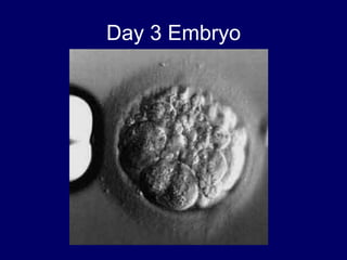 Day 3 Embryo
 