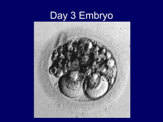 Day 3 Embryo
 
