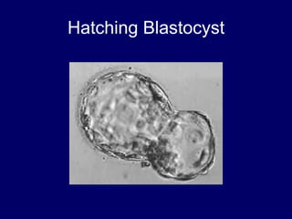 Hatching Blastocyst
 