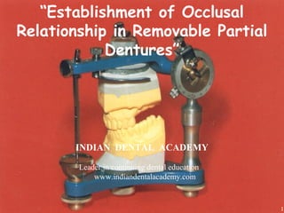 “Establishment of Occlusal
Relationship in Removable Partial
Dentures”
1
INDIAN DENTAL ACADEMY
Leader in continuing dental education
www.indiandentalacademy.com
 