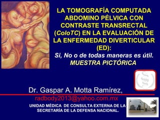 LA TOMOGRAFÍA COMPUTADA
ABDOMINO PÉLVICA CON
CONTRASTE TRANSRECTAL
(ColoTC) EN LA EVALUACIÓN DE
LA ENFERMEDAD DIVERTICULAR
(ED):
Si, No o de todas maneras es útil.
MUESTRA PICTÓRICAMUESTRA PICTÓRICA
Dr. Gaspar A. Motta Ramírez,
radbody2013@yahoo.com.mx
UNIDAD MÉDICA DE CONSULTA EXTERNA DE LA
SECRETARÍA DE LA DEFENSA NACIONAL.
 