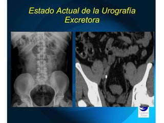 Estado Actual de la Urografía Excretora 