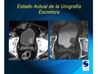 Estado Actual de la Urografía Excretora 