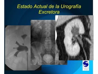 Estado Actual de la Urografía Excretora 