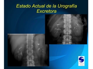 Estado Actual de la Urografía Excretora 