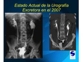 Estado Actual de la Urografía Excretora en el 2007 