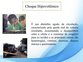 Choque Hipovolêmico
É um distúrbio agudo da circulação,
caracterizado pela queda real do volume
circulante, ocasionando o desequilíbrio
entre a oferta e o consumo de oxigênio
para os tecidos e as principais causas são
hemorragias, vômitos, diarreias, diurese
maciça e queimaduras.
 