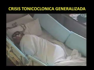 CRISIS TONICOCLONICA GENERALIZADA
 