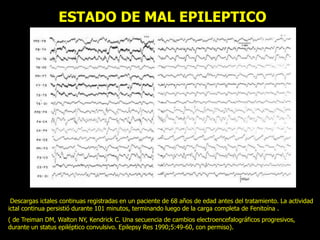 ESTADO DE MAL EPILEPTICO
Descargas ictales continuas registradas en un paciente de 68 años de edad antes del tratamiento. La actividad
ictal continua persistió durante 101 minutos, terminando luego de la carga completa de Fenitoína .
( de Treiman DM, Walton NY, Kendrick C. Una secuencia de cambios electroencefalográficos progresivos,
durante un status epiléptico convulsivo. Epilepsy Res 1990;5:49-60, con permiso).
 