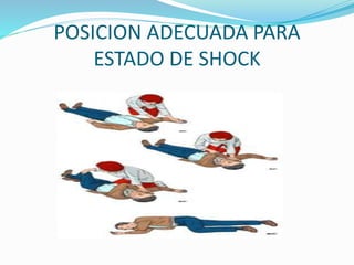 POSICION ADECUADA PARA 
ESTADO DE SHOCK 
 