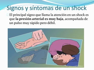Signos y síntomas de un shock 
 El principal signo que llama la atención en un shock es 
que la presión arterial es muy baja, acompañada de 
un pulso muy rápido pero débil. 
 