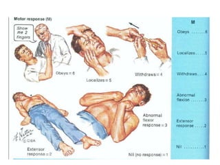 Alteraciones de la conciencia
