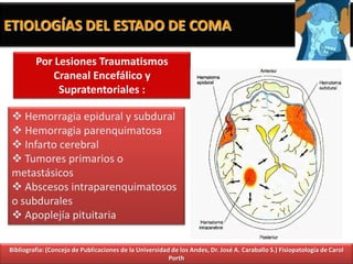 ETIOLOGÍAS DEL ESTADO DE COMA

         Por Lesiones Traumatismos
            Craneal Encefálico y
              Supratentoriales :

  Hemorragia epidural y subdural
  Hemorragia parenquimatosa
  Infarto cerebral
  Tumores primarios o
 metastásicos
  Abscesos intraparenquimatosos
 o subdurales
  Apoplejía pituitaria

Bibliografía: (Concejo de Publicaciones de la Universidad de los Andes, Dr. José A. Caraballo S.) Fisiopatología de Carol
                                                         Porth
 
