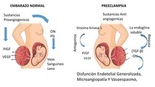 Estados hipertensivos del embarazo