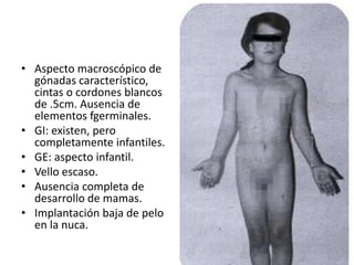 • Aspecto macroscópico de
gónadas característico,
cintas o cordones blancos
de .5cm. Ausencia de
elementos fgerminales.
• GI: existen, pero
completamente infantiles.
• GE: aspecto infantil.
• Vello escaso.
• Ausencia completa de
desarrollo de mamas.
• Implantación baja de pelo
en la nuca.

 