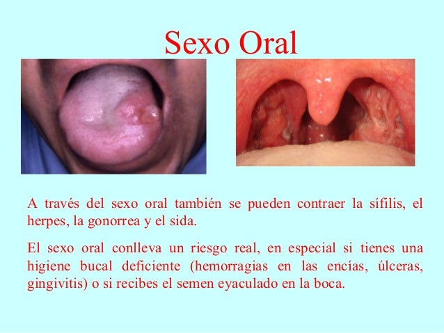 Consecuencias Del Sexo Anal 104