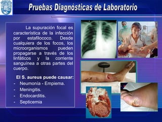 Pruebas Diagnósticas de Laboratorio La supuración focal es característica de la infección por estafilococo. Desde cualquiera de los focos, los microorganismos pueden propagarse a través de los linfáticos y la corriente sanguínea a otras partes del cuerpo. El S. aureus puede causar: Neumonía  -  Empiema. Meningitis. Endocarditis. Septicemia 