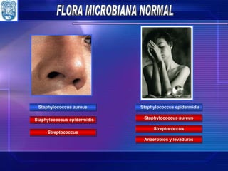 Staphylococcus epidermidis Staphylococcus aureus Streptococcus Staphylococcus aureus Staphylococcus epidermidis Streptococcus Anaerobios y levaduras FLORA MICROBIANA NORMAL 