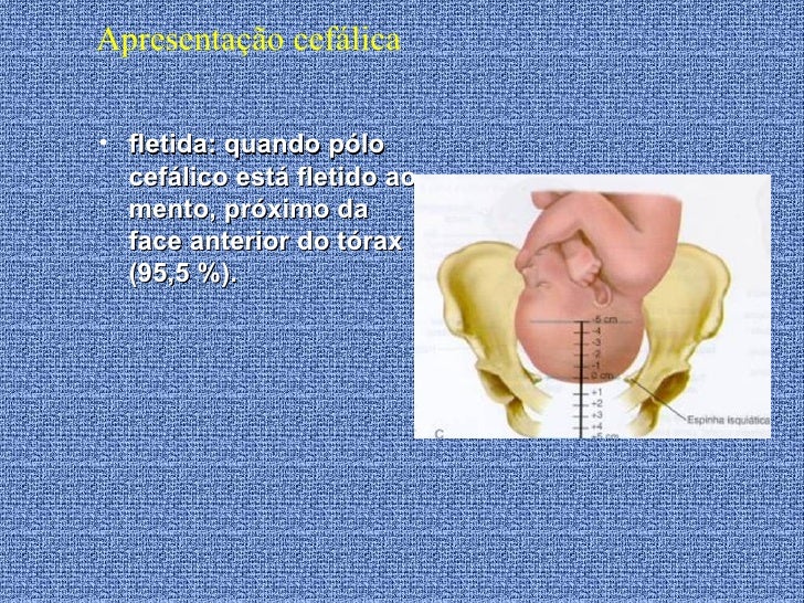 Apresentação Cefalica Com Dorso A Esquerda O Que Significa
