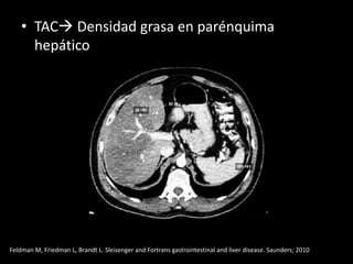 • TAC Densidad grasa en parénquima
hepático
Feldman M, Friedman L, Brandt L. Sleisenger and Fortrans gastrointestinal and liver disease. Saunders; 2010
 